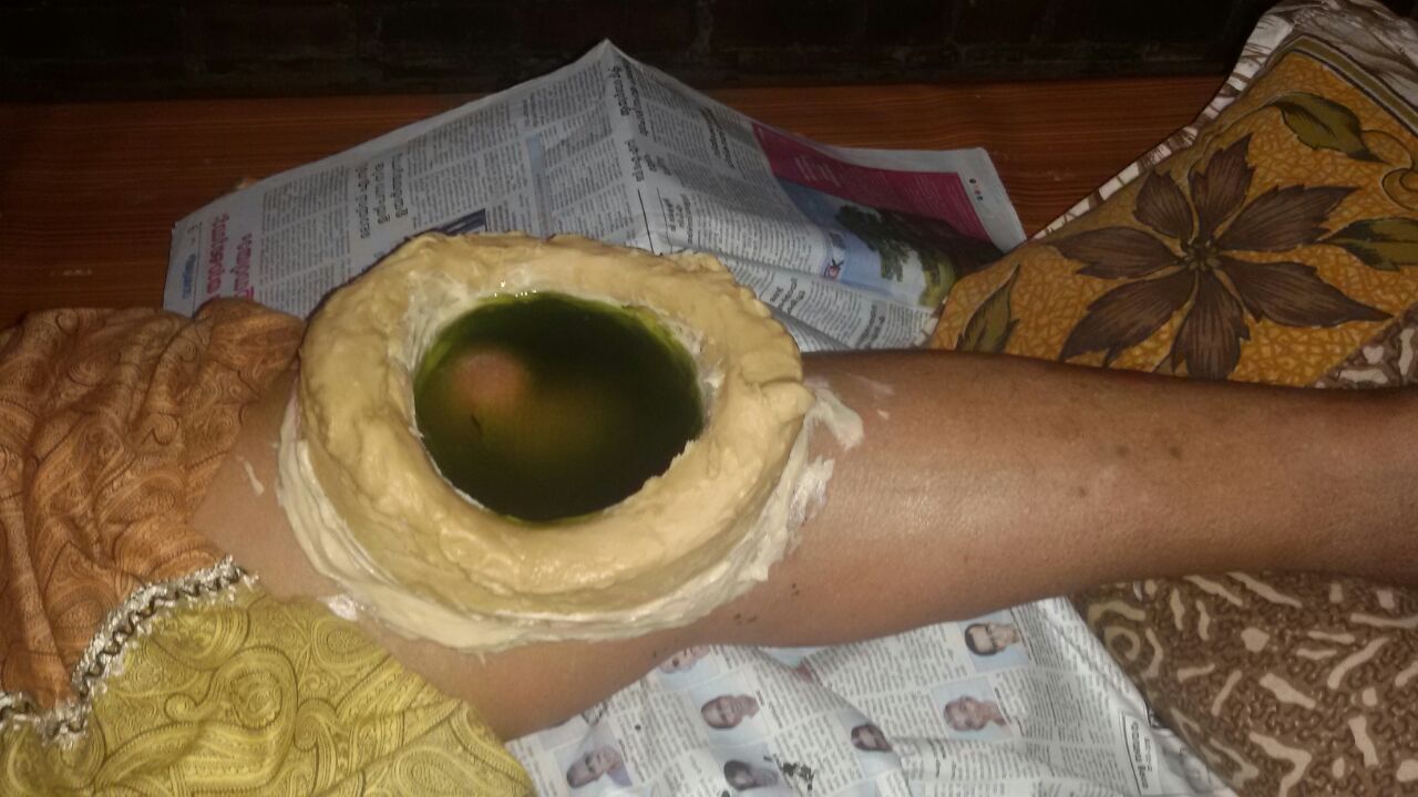 Janu Vasti therapy, Sree Nandanam Ayurveda Hospital, Attingal, Thiruvananthapuram