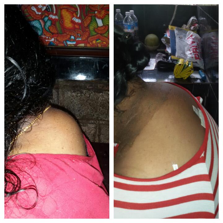 obesity disorder therapy at Sree Nandanam Ayurveda Hospital, Attingal, Thiruvananthapuram