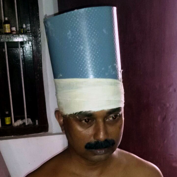 Shirovasti (Medicated Oil Retention Therapy for Head) at Sree Nandanam Ayurveda Hospital, Attingal, Thiruvananthapuram